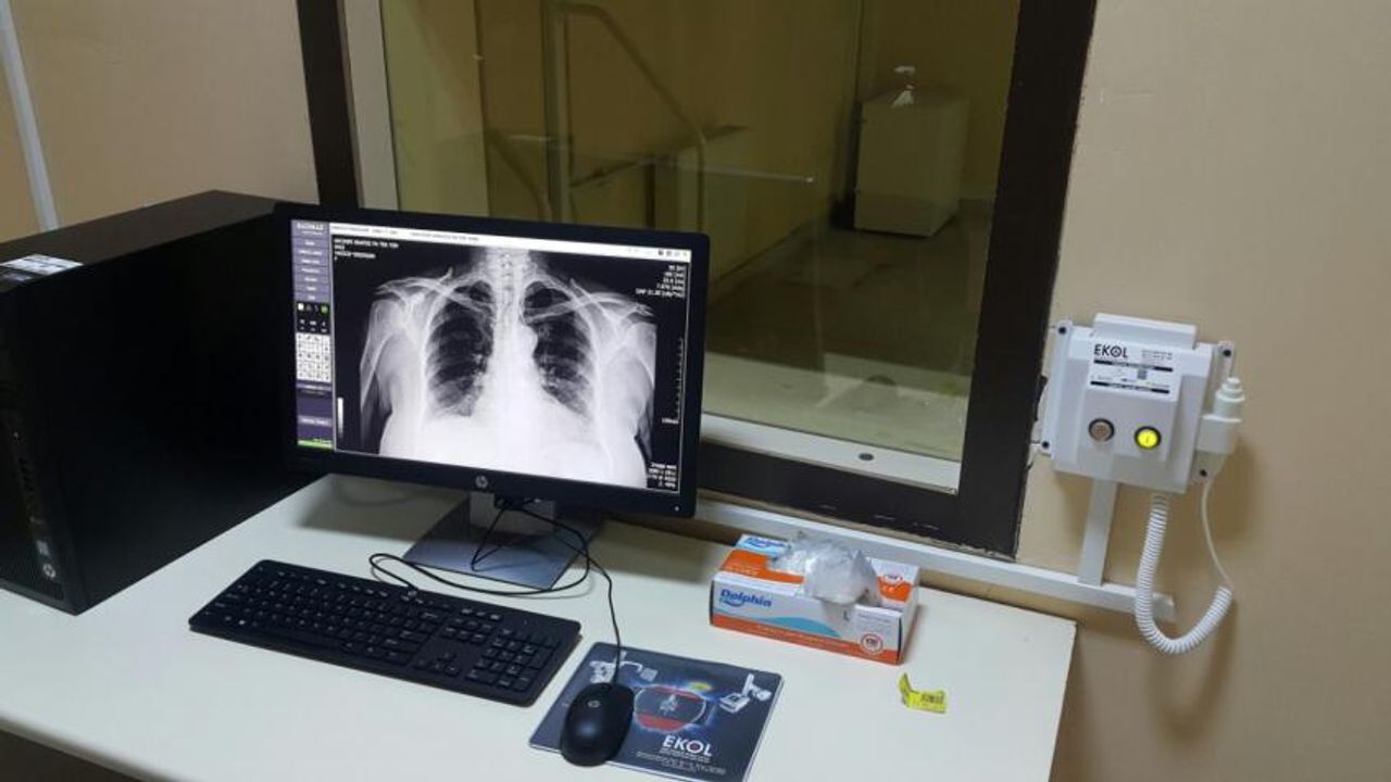 Dijital Röntgen Cihazı Kuruldu