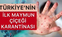 Türkiye’nin İlk Maymun Çiçeği Vakası: Karantinaya Alındılar