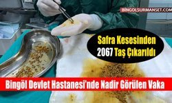 Safra Kesesinden 2067 Taş Çıkarıldı