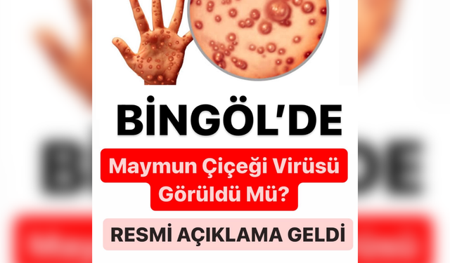 Bingöl Devlet Hastanesi’nden Maymun Çiçeği Hastalığı İddialarına Sert Yanıt!